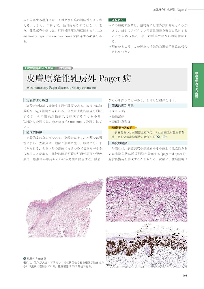 Amazon.co.jp: 皮膚病理診断リファレンス 第2版 : 安齋眞一
